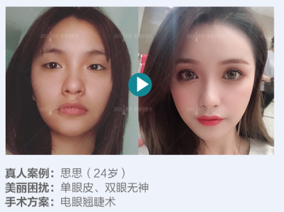 王永久_福州爱美尔医疗美容院长眼部专家