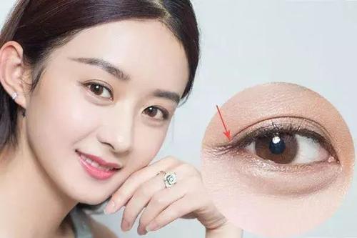 上海九院双眼皮医生哪个最好？