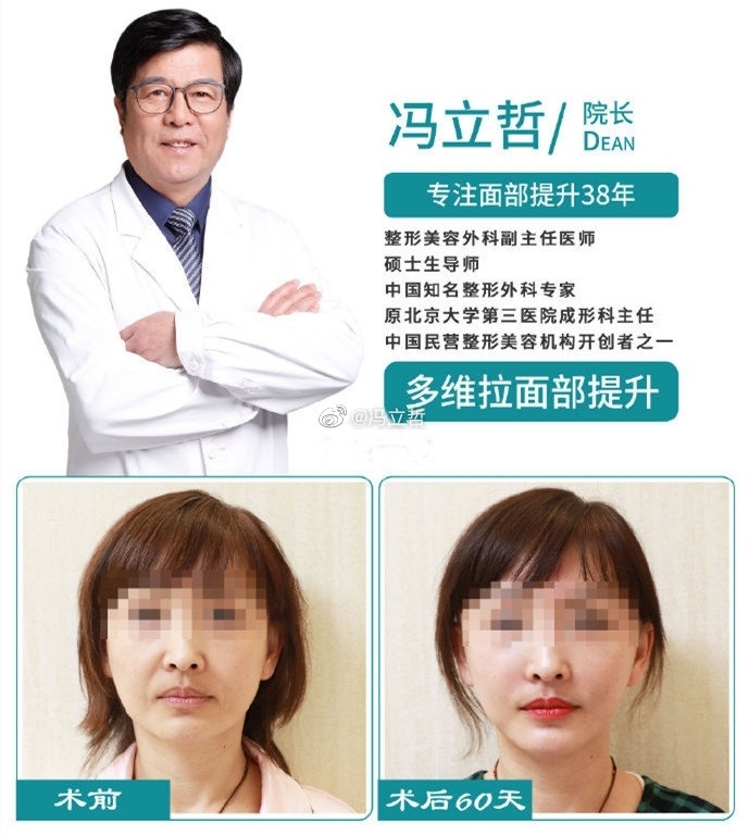 冯立哲和李晓东哪个是专业做面部提升