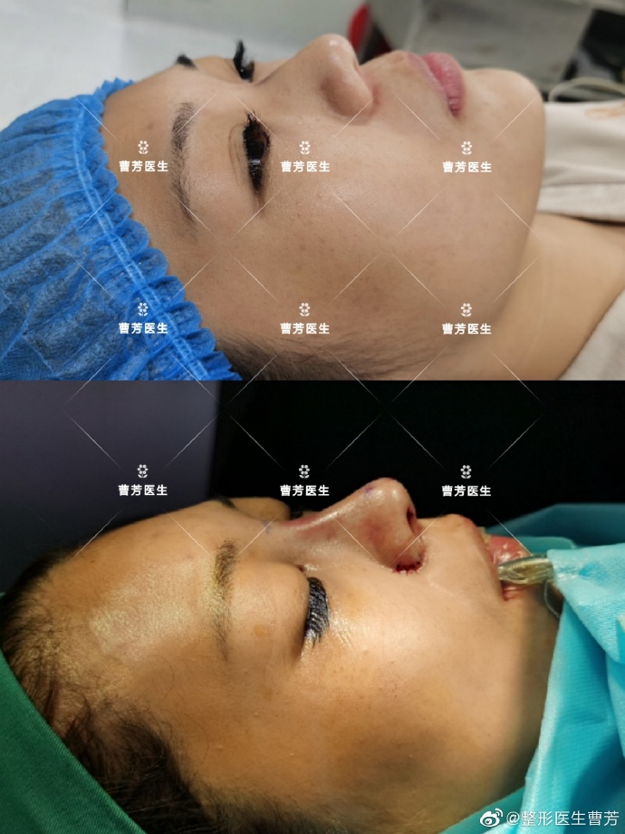 上海薇琳整形的曹芳口碑怎么样