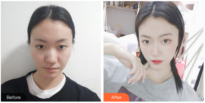福州隆鼻比较好的医生