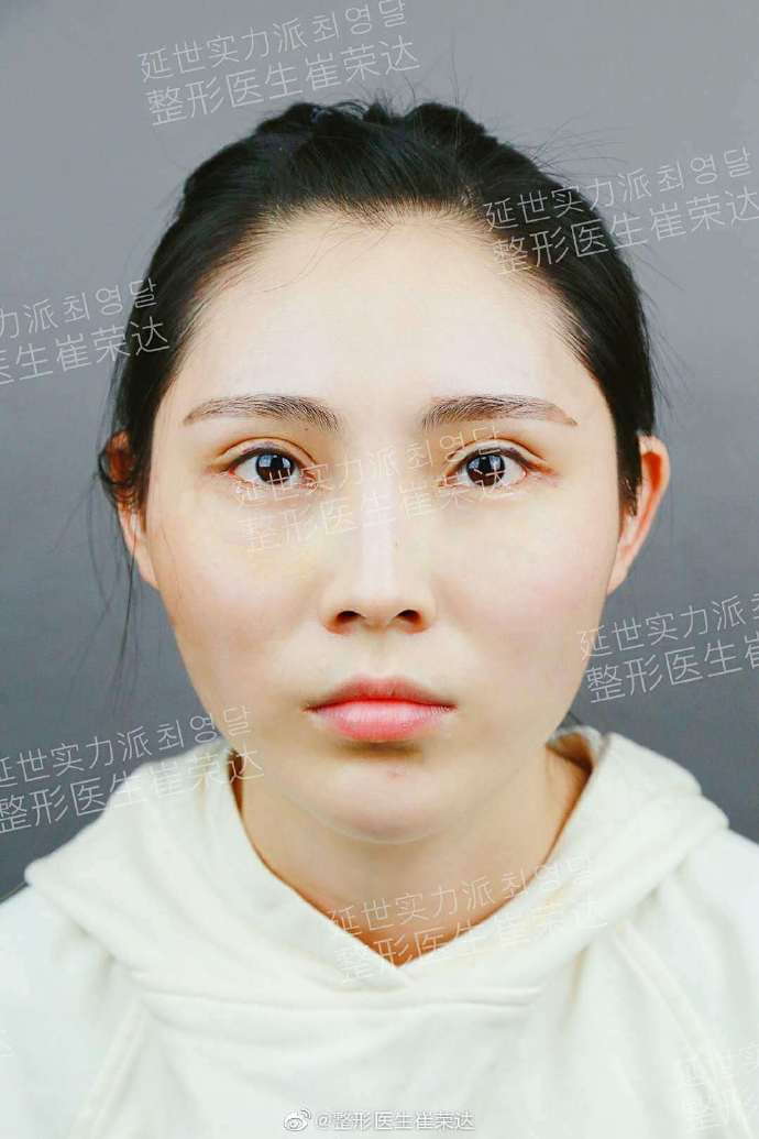 上海首尔丽格、华美、时光、伊莱美哪家磨骨好？