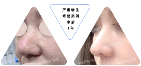 长沙熊宜文和范鹏举哪个整鼻子厉害