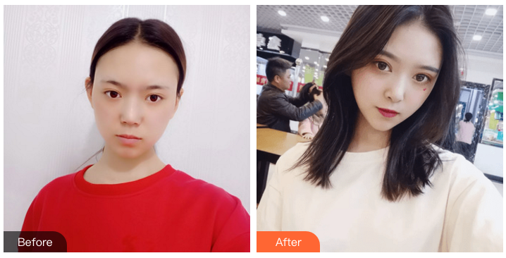 长沙做隆鼻哪个医生做得好