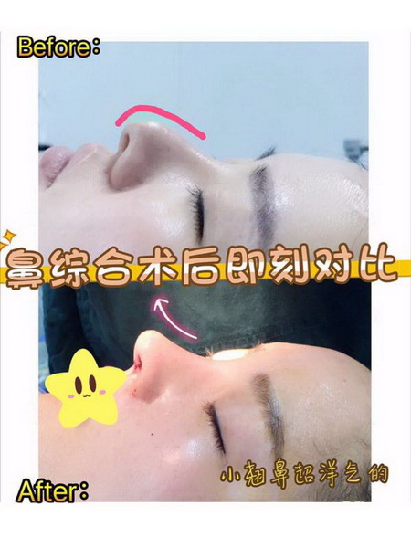 北京八大处鼻子谁做得好？
