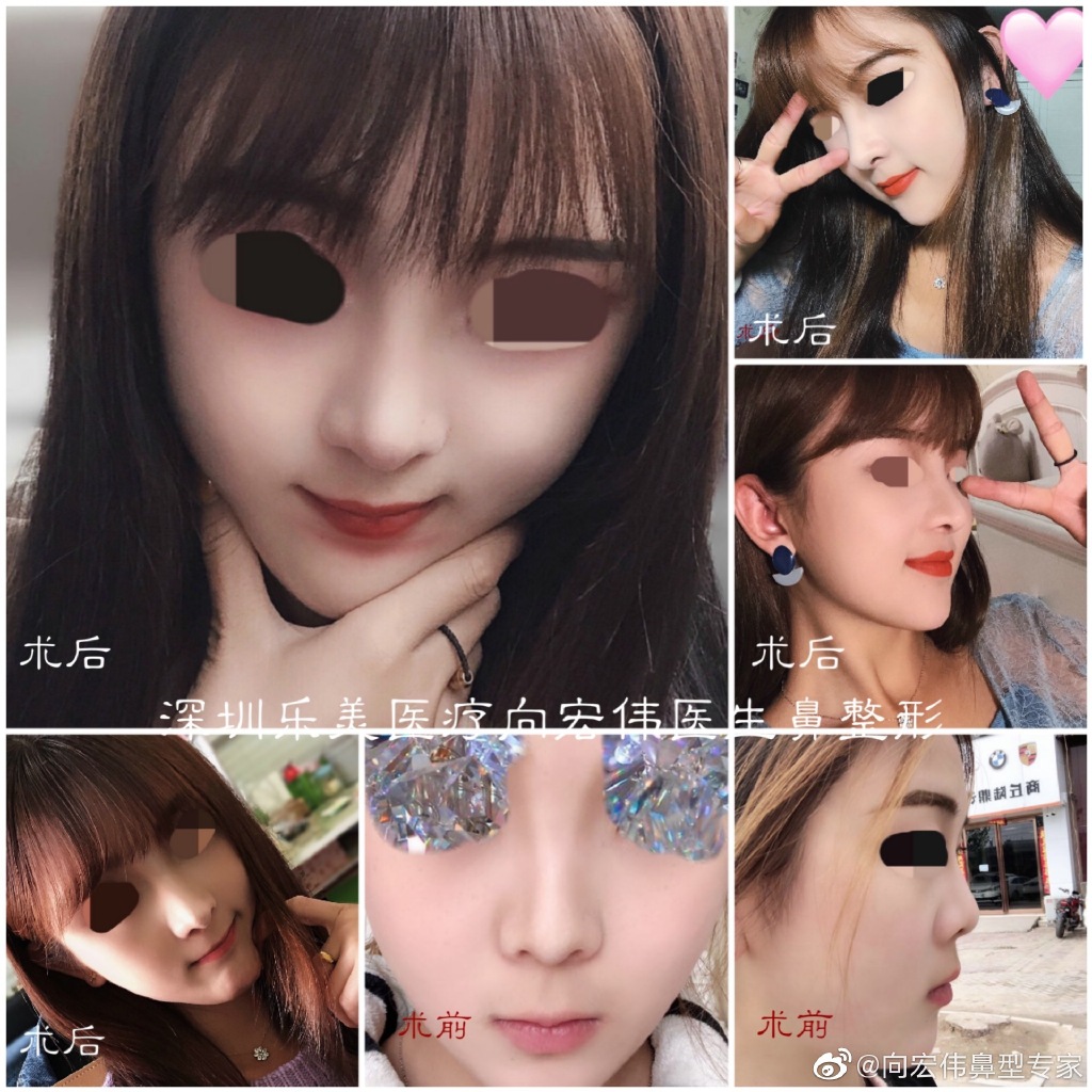 2020年深圳鼻综合的医生排名