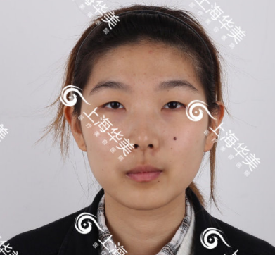 上海华美杨亚益和佀同帅哪个好做双眼皮