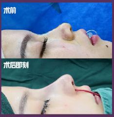 深圳知名鼻综合专家是谁
