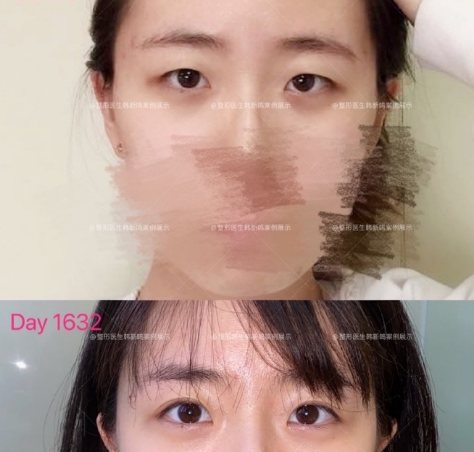 双眼皮韩新鸣和许莲姬谁做的好