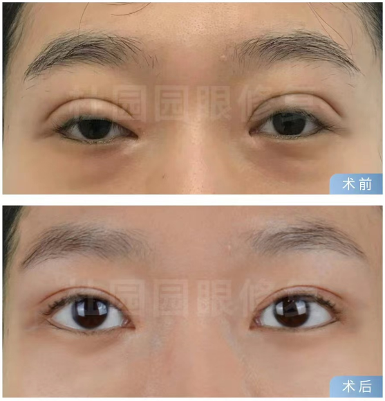 上海眼修复好的医生排名前十有哪些？2025年上海眼修复专家预约前十名