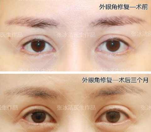 张冰洁和王世勇哪个审美好