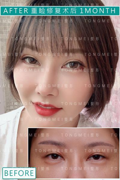 刘风卓和魏志香哪个修复好