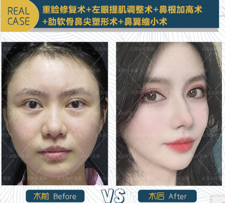 郑永生和王世勇谁做修复好