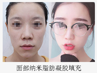 李剑_长沙半岛整形医院技术院长