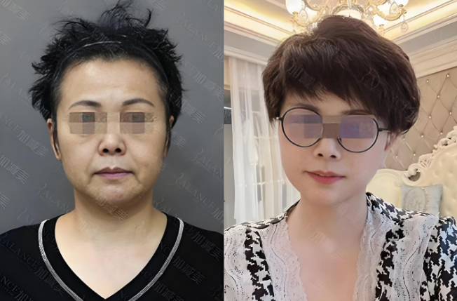 北京拉皮技术最好的医生前十名:黄寅守、杜太超、李晓东、杨俊、张利民、王志坚、袁强、谢宏彬、祝东升、张海明