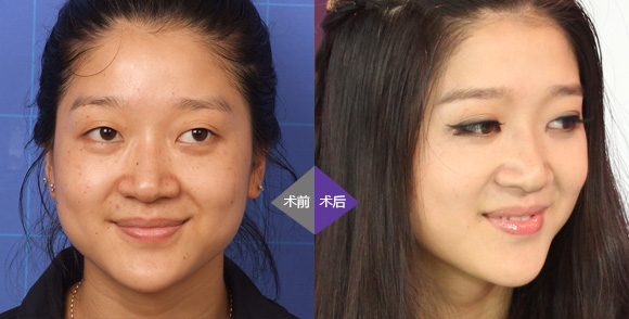 臧剑芳_国内首批研究皮肤激光美容专家之一