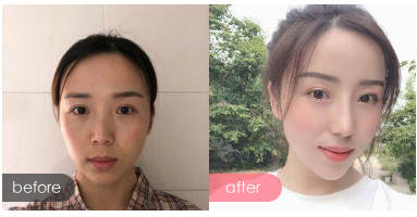 西安做隆鼻哪个大夫好