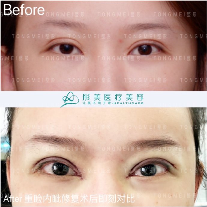 北京刘风卓跟王世勇哪个修复做的更好