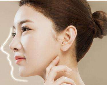 广州做隆鼻修复最好的医生是谁