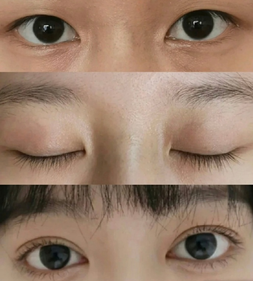 全国眼综合整形最好的医生是哪个