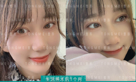 北京哪个医生做眼综合最好