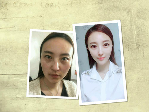 上海九院面部填充哪个医生好