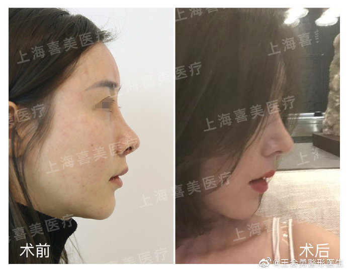 国内顶级修复鼻子专家都有哪些？谁更权威？