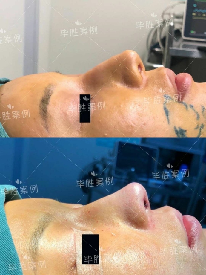 重庆比较权威的鼻综合医生是哪个