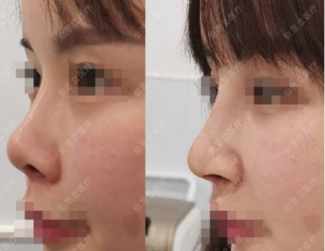 上海鼻修复做的好的医生