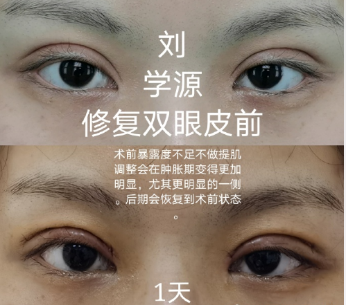 山东比较好的眼修复专家有哪些