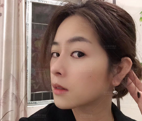 中国知名鼻修复专家哪个最好