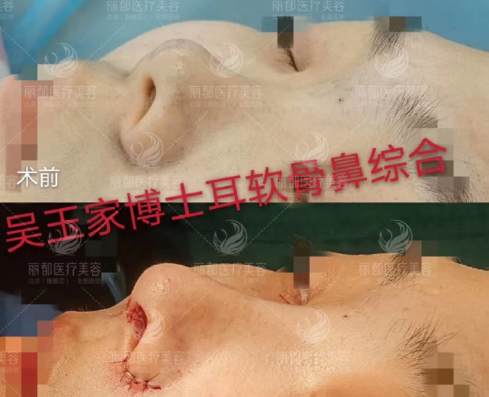 国内鼻整形修复大师都有谁