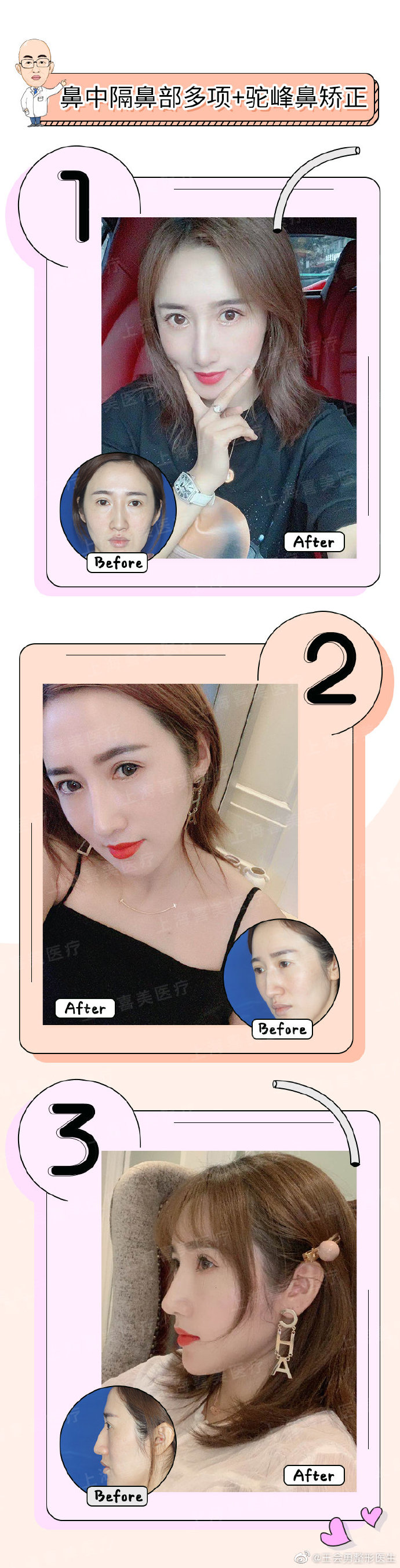 上海王会勇和郑州牛永敢鼻修复哪个好？