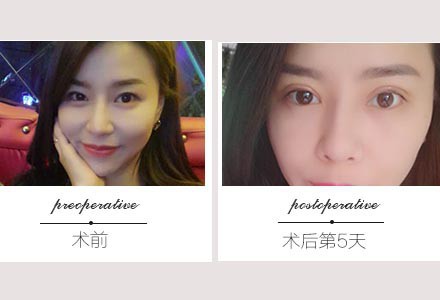 昆明哪个医生做眼部修复比较好