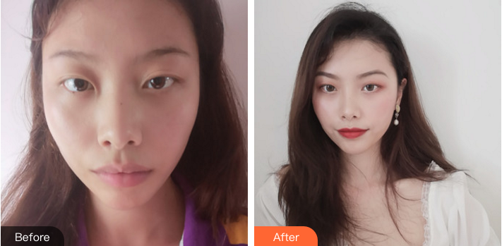 哈尔滨做鼻综合哪个医生好