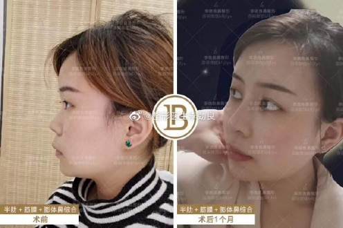 中国做鼻子最好的医生