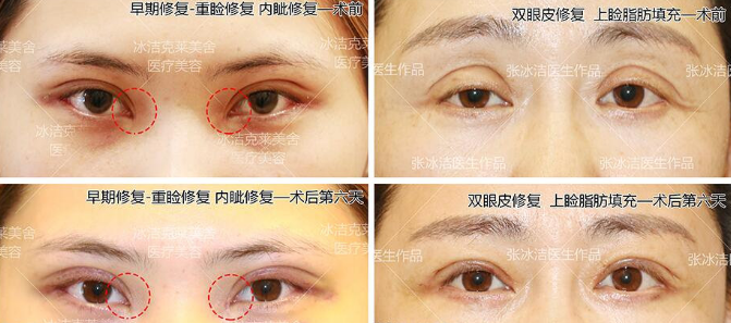 北京张冰洁王振军哪个修复好