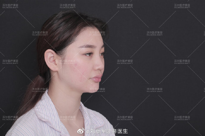 北京刘彦军、李劲良、王军和李长赋哪个做鼻修复技术好？