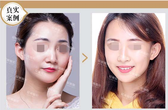 许建平_重庆军美整形皮肤美容中心主任