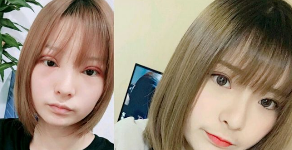 上海九院做双眼皮哪个专家比较好