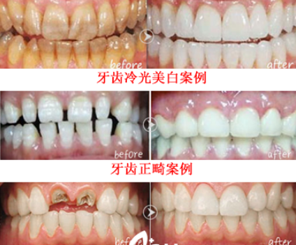 闫路_合肥华美口腔种植修复主任