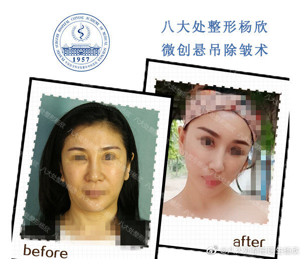 北京八大处面部年轻化哪个医生厉害？