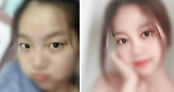 福州有哪些割双眼皮好的医生