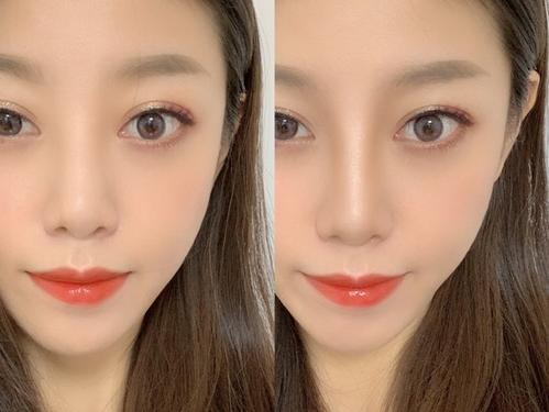 北京八大处谁做鼻子好