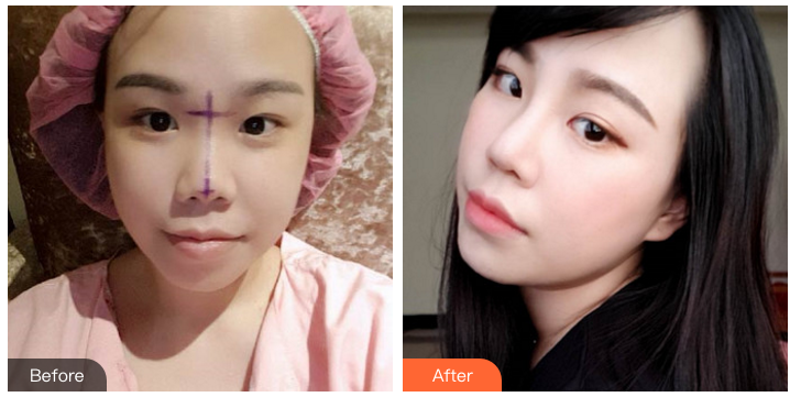 西安隆鼻哪个医生好