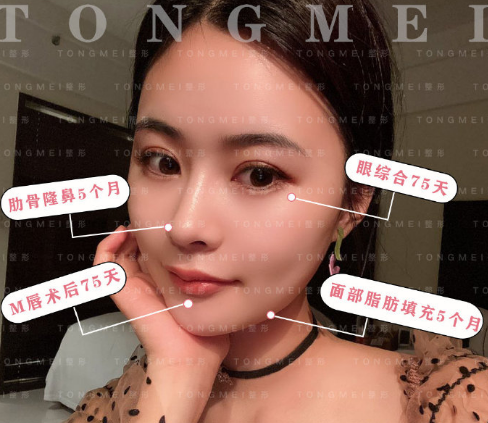 北京鼻子修复最好的医生是谁