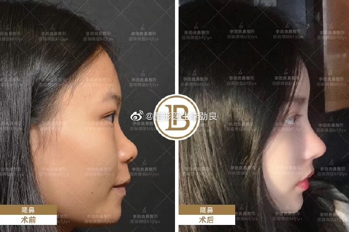 鼻修复国内哪个医生比较好？