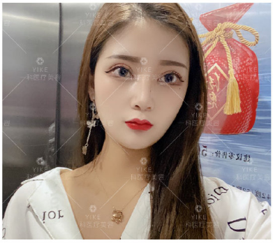 郑州鼻综合做得好的医生