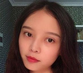 上海九院割双眼皮哪个专家最好