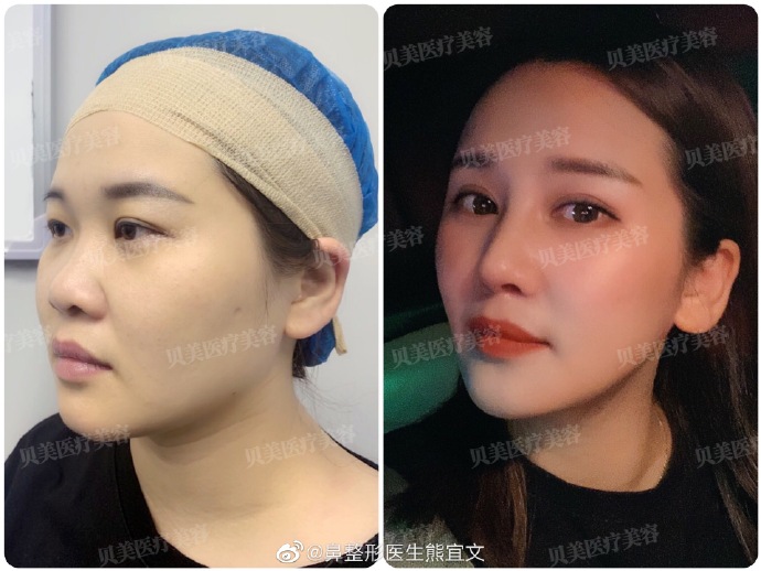 长沙哪个医生做鼻综合最好